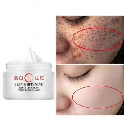 Best Quality Whitening Cream Dark Spot Remover Cream Face Pigment Melasma and Freckles Removal Cream