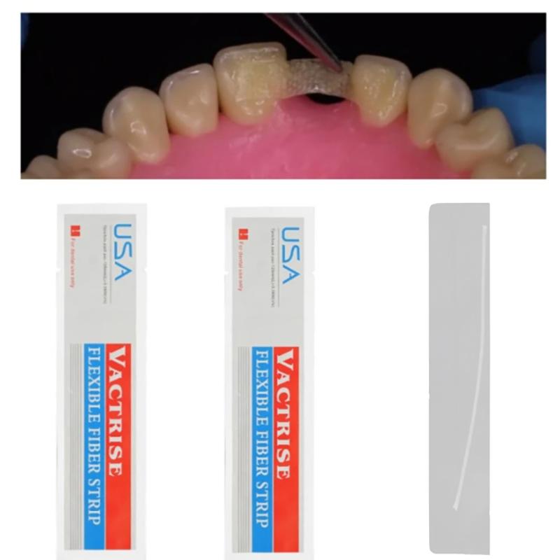 Lot de 7 bandes de fixation pour dents lâches en fibre de verre, matériau dentaire flexible, fixation par photopolymérisation, fixation orthodontique