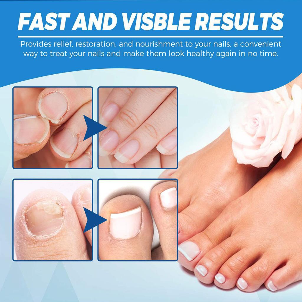 Tužka s modrým světlem na nehty, Šedá tužka na nehty, Snadné použití, Odstraňovač zápachu, Péče o nehty