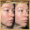 Revolution Pro Miracle Night Rescue Serum Advanced Complex Night Serum