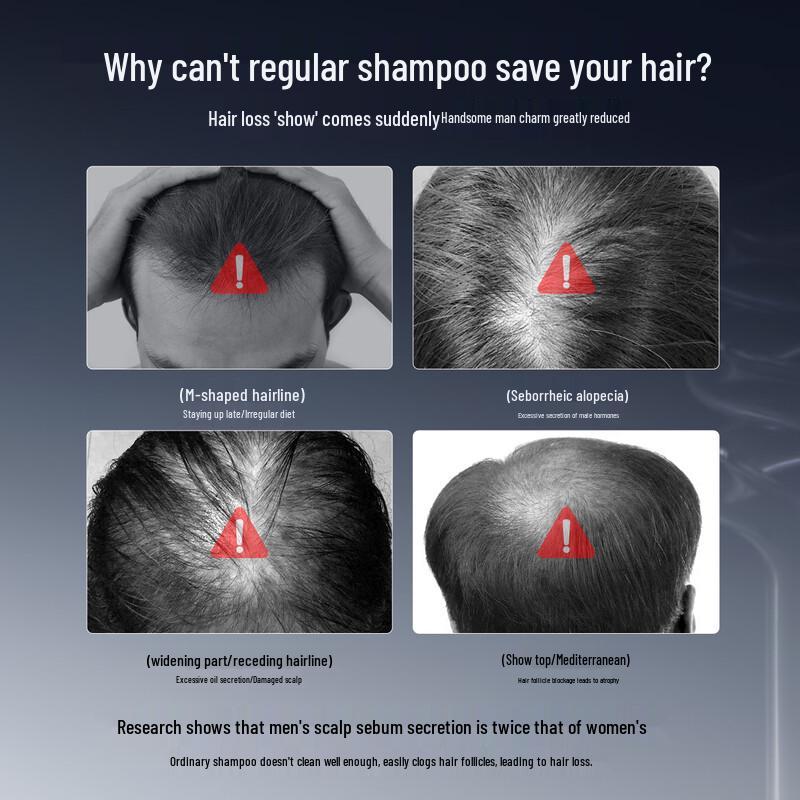 Three Hair Wizards Men's Anti-Hair Loss Shampoo