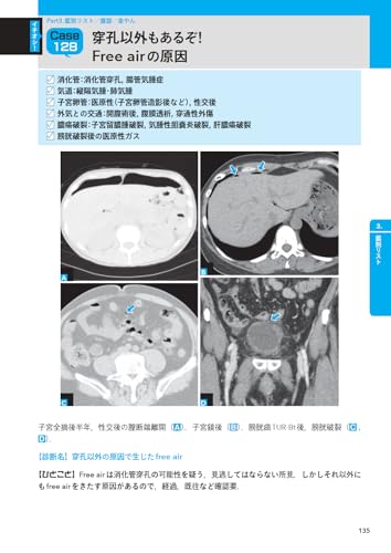 X-Ray! 10-Second Imaging Diagnostics: Practical Knowledge Learned from Influencers