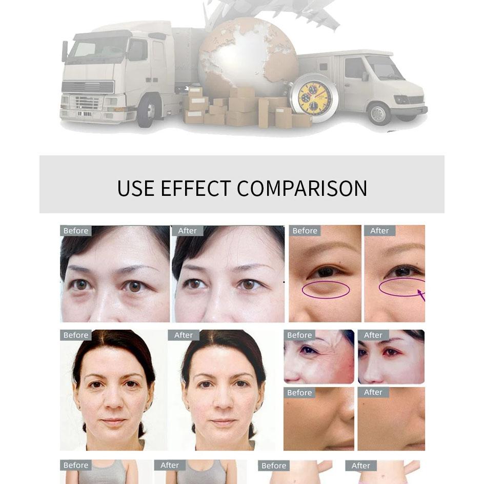 40K Ultrasonic Cavitation RF Machine for Body Facial Slimming Fat Reduction