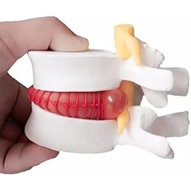 BoNew-Oral 1:1.5 Anatomical Human Lumbar Vertebrae Degenerative Lumbar Human Spine Model White Color