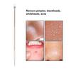 Blackhead Remover Whitehead Acne Removal Stainless Steel Pimple Popper Extractor Tool