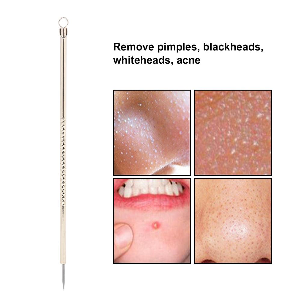 Blackhead Remover Whitehead Acne Removal Stainless Steel Pimple Popper Extractor Tool
