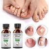 10ML Toenail Nail Fungus Treatment Repair Fingernail Device Foot Toenail Fungus Essential Care F0N3