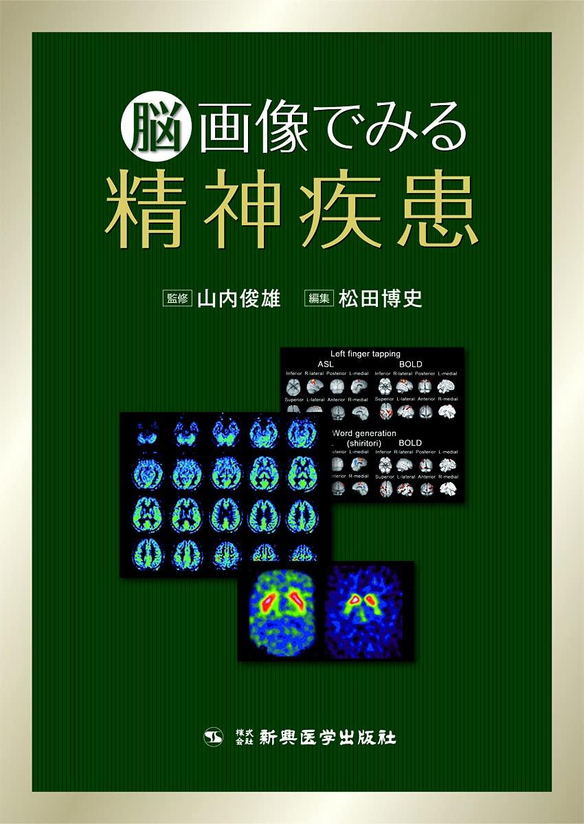 Mental illness as seen through brain imaging