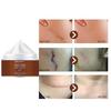 Creams, Skin Wounds, Creams, Burns, Fading Creams, Surgical Repairs, Skin Care, Skin Whitening Creams