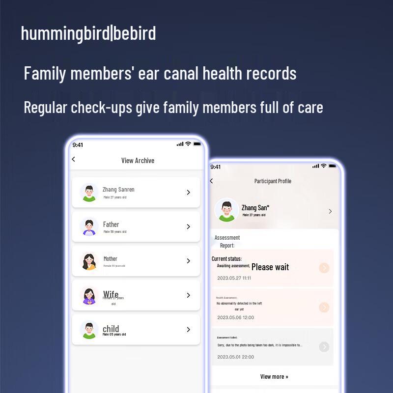 BEBIRD מנקה אוזניים חכם ויזואלי