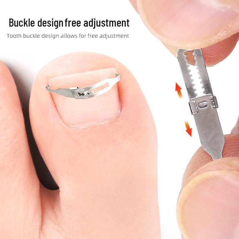 Ingrown Toenail Orthotic Patch & Foot Care Tool for Curled Nails and Nail Groove Ingrowth