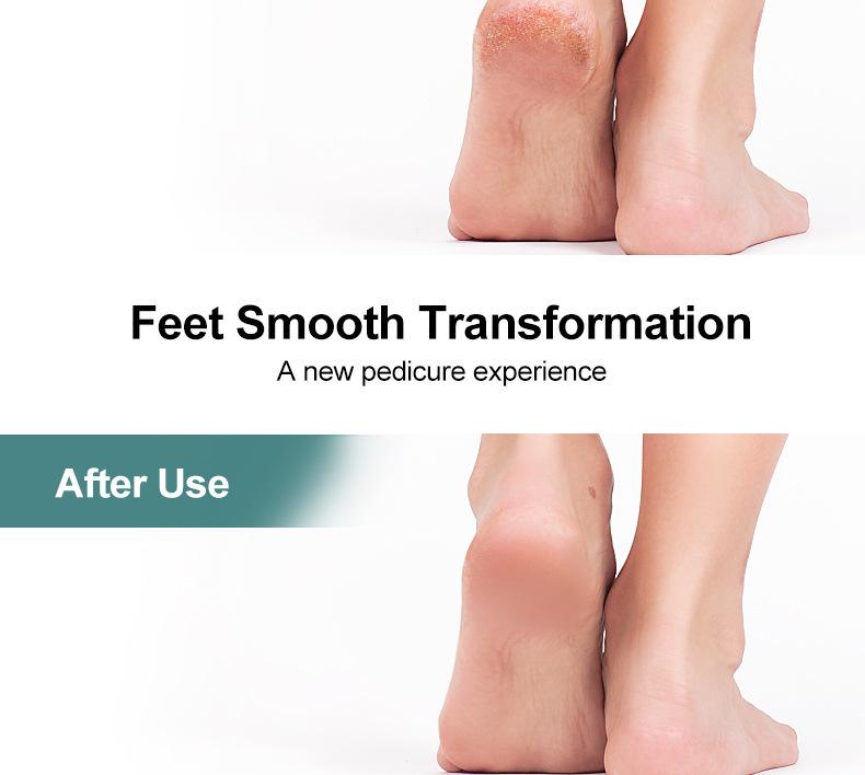 Dual-Sided Stainless Steel Pedicure Foot File - Callus and Dead Skin Remover