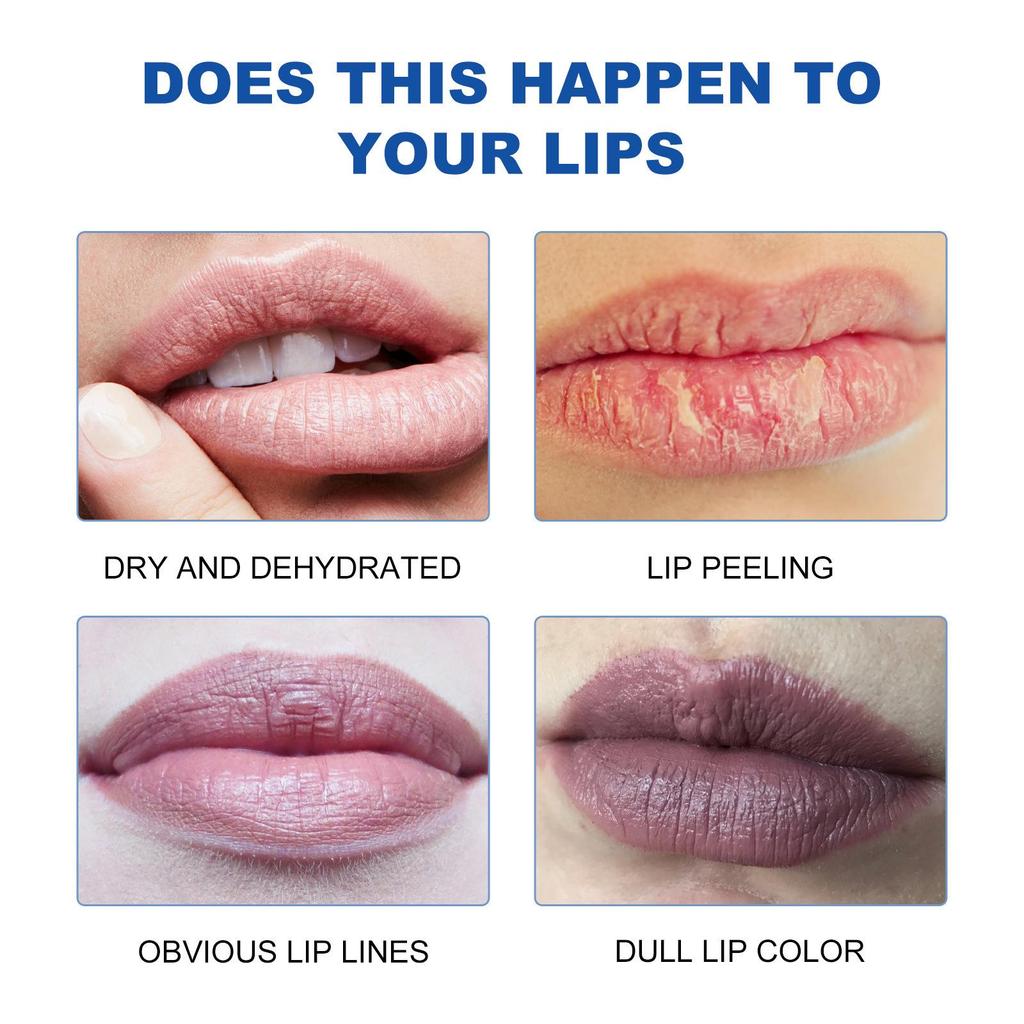 West Month Dark Spot Correcting Lip Balm Moisturizing & Hydrating Reduces Lip Lines Relieves Dryness Plumps & Softens For Lips 3g