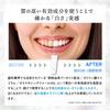 Kyogoku Crystal Whitening Gel, Medicated Toothpaste, Whitens Teeth, Supervised by Dental Hygienists, Quasi-drug