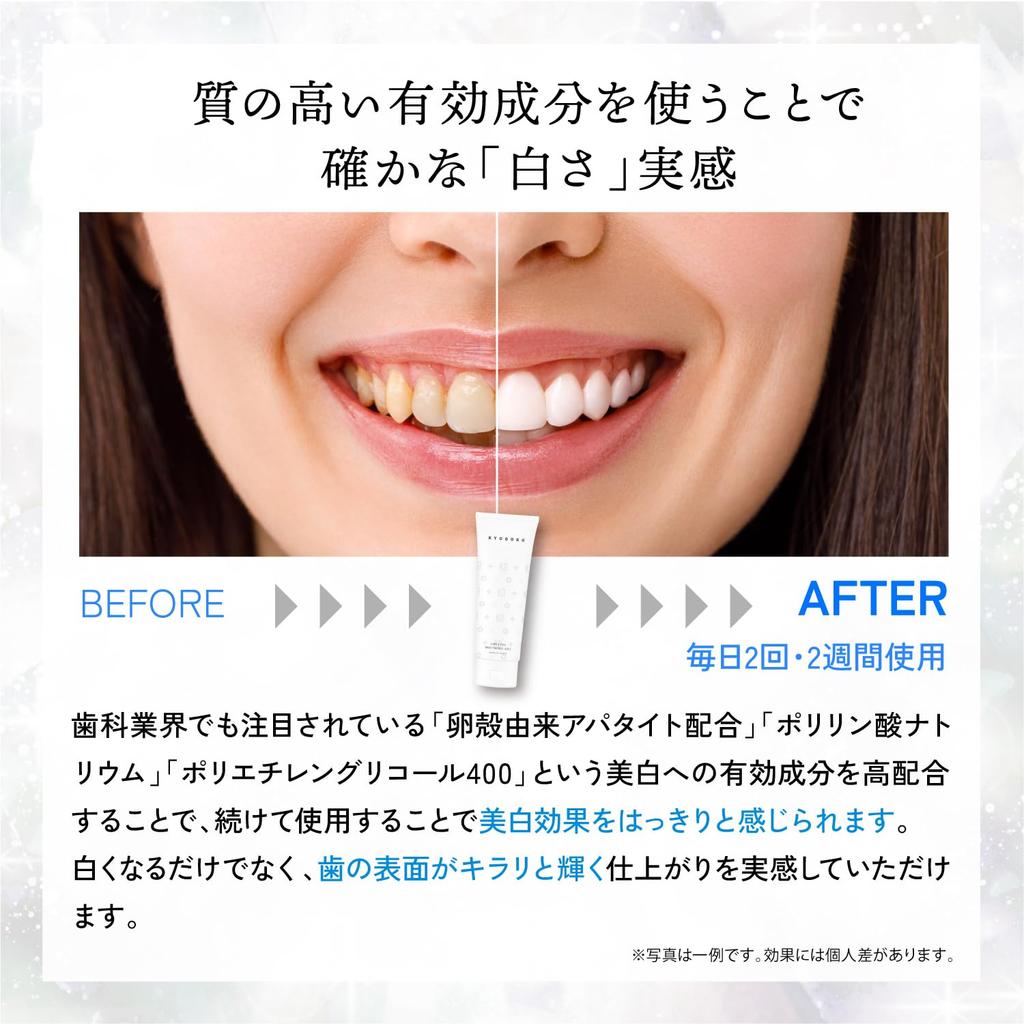 Kyogoku Crystal Whitening Gel, Medicated Toothpaste, Whitens Teeth, Supervised by Dental Hygienists, Quasi-drug