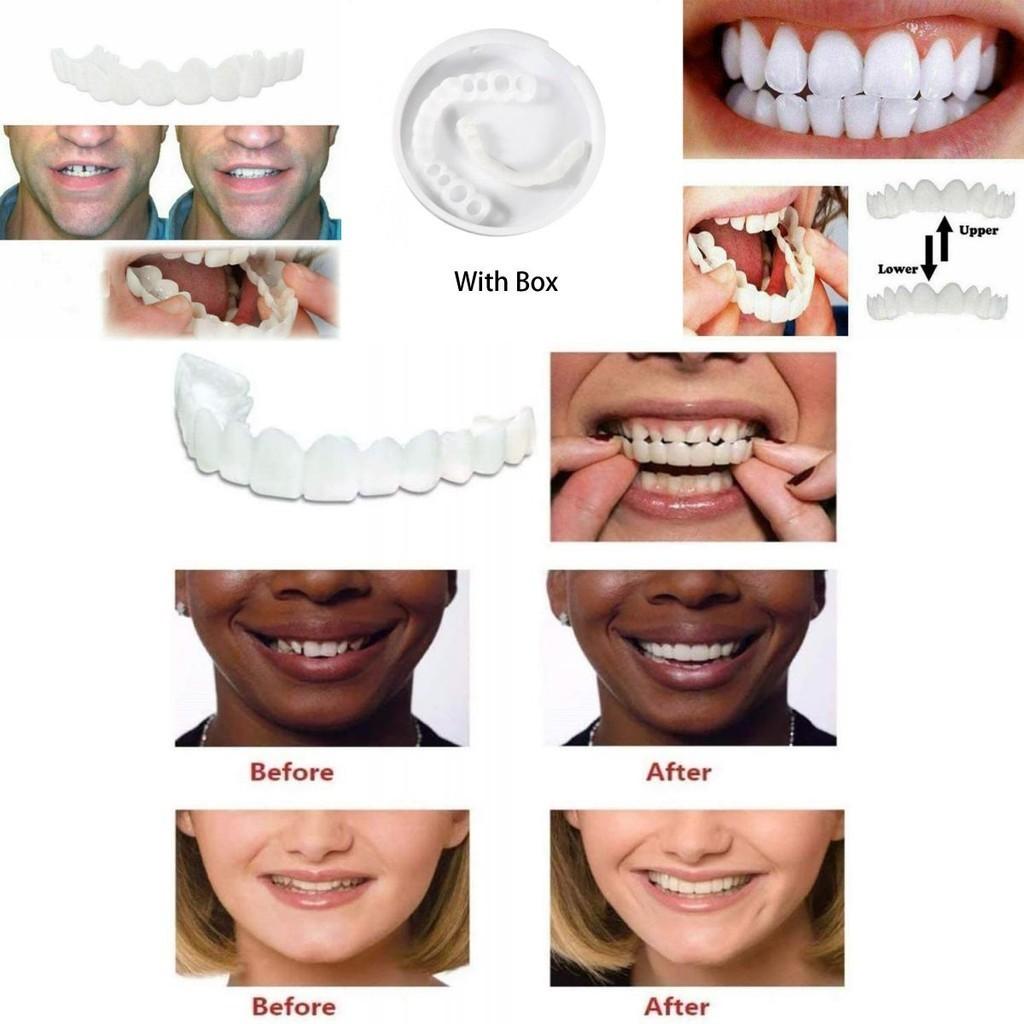 Fake Snap On Teeth Upper Lower Dental Veneers Denture Tooth Cover Set Simulation