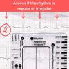 EKG-7-Stufen-Lineal zur Interpretation von Elektrokardiogrammen, transparente EKG-Linealkarte, EKG-Taschentool, tragbares Elektrokardiogramm-Referenzhandbuch für Studenten