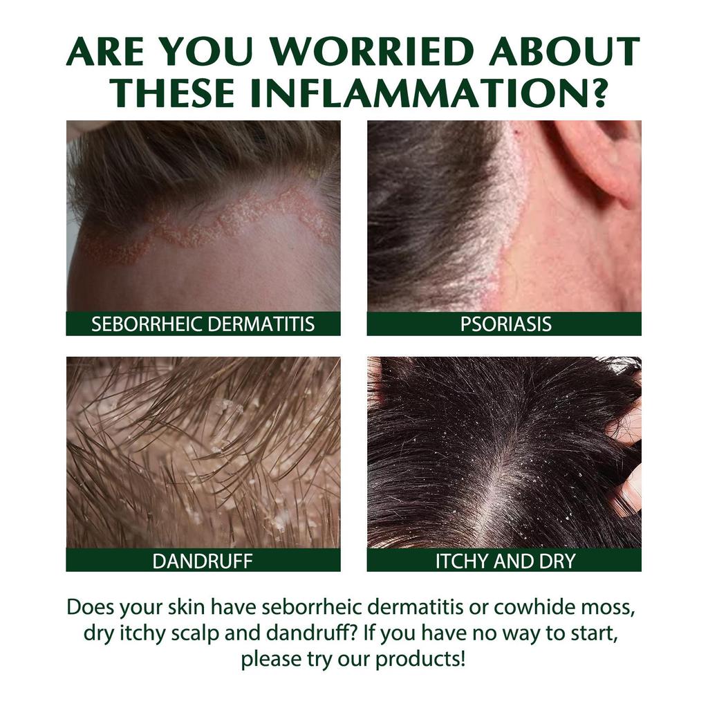 South Moon Scalp Care Shampoo 100ml Gently Cleanses, Controls Oil, and Adds Volume, Leaving Hair Smooth and Full-bodied.