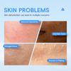 LAIKOU Hyaluronic Acid Collagen Cream 30g Hydrating and Moisturizing