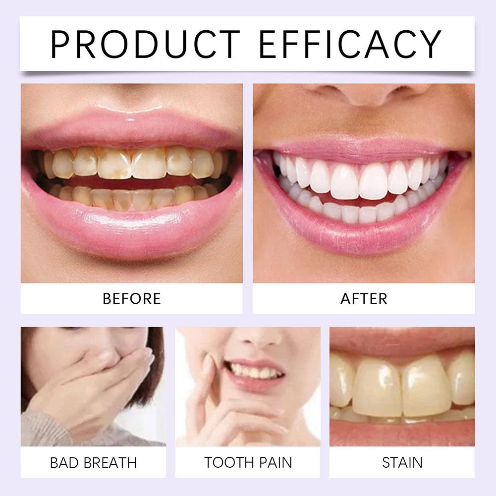7 buc. Benzi Violet pentru Albirea Dinților Îndepărtarea Profesională a Petelelor Dentare Kit de Albire Dentară pentru Dinți Sensibili Îngrijire Orală
