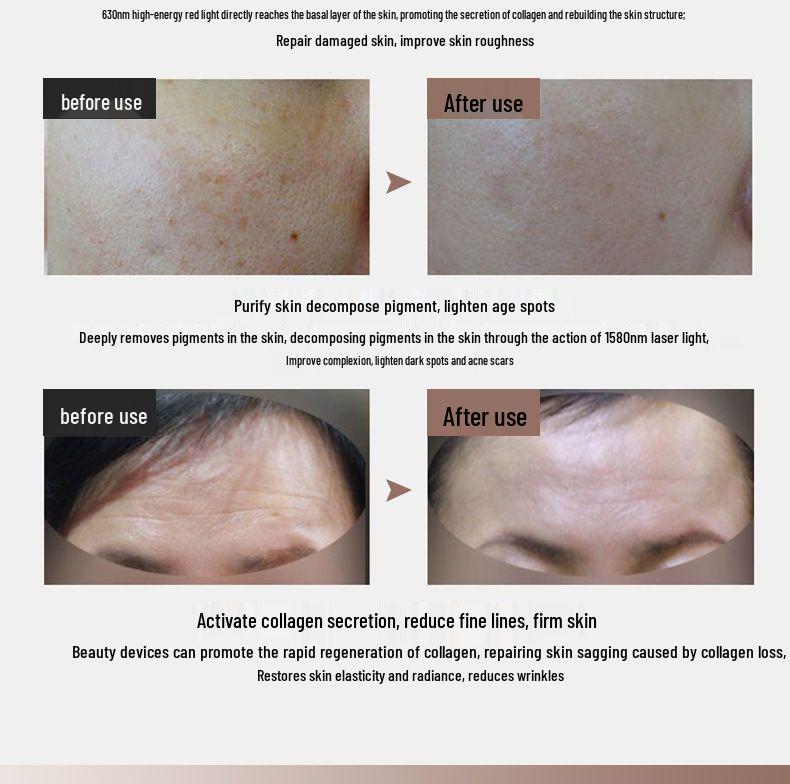 Photon Rejuvenation LED Facial Mask - Home Whitening & Beauty Device