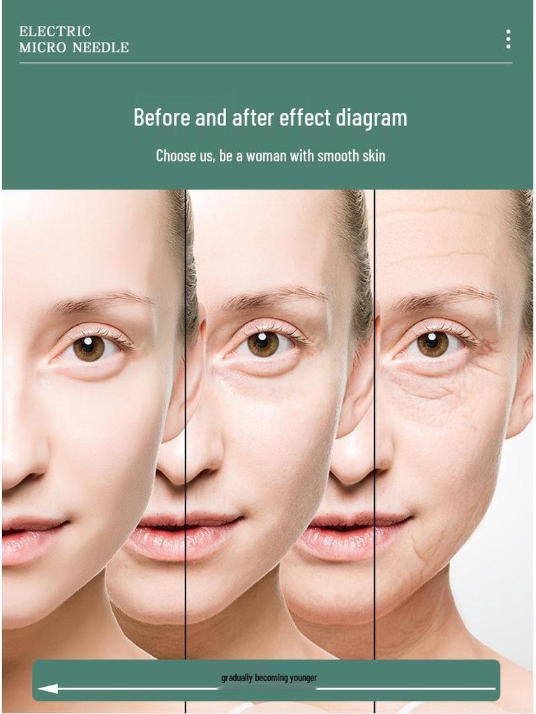 Beauty Gold 20-Pin Micro-Needle Stamp & Water-Soluble Needles - Portable Manual Press