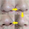 20pcs Blackhead Nose Strips Deep Cleansing Nasal Spot Facial Dot Stickers Nose Mask Shill For Acne & Black Head