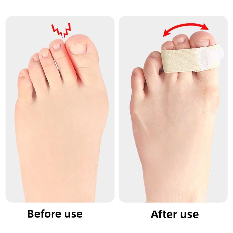 Finger Splitter Day and Night Overlap Thumb Valgus with Bandage Wear Middle Toe Stretcher Elastic Cloth Toe Strap