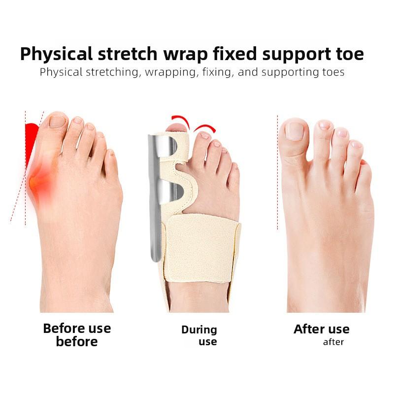 Thumb Valgus Toe Strap Splint Bracket Toe Big Foot Protrusion Protective Cover Toe Protector Toe Splitter