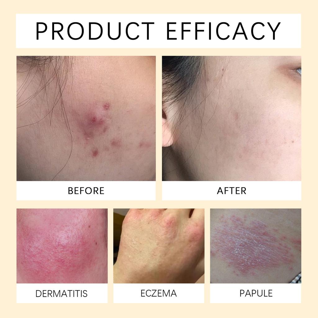 Bienenhautcreme hellt Pigmentierung auf, strafft, spendet Feuchtigkeit und lässt den Teint strahlen.. Hautcreme