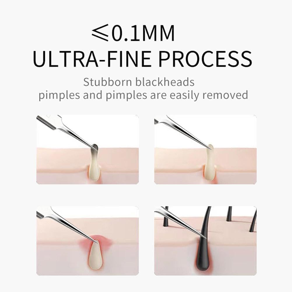 3 Pcs Silver Professional Blackhead Tweezer Professional Facial Blackhead Remover Tweezers Precision Extractor Acne Removal Kit Pimple Popper Tools