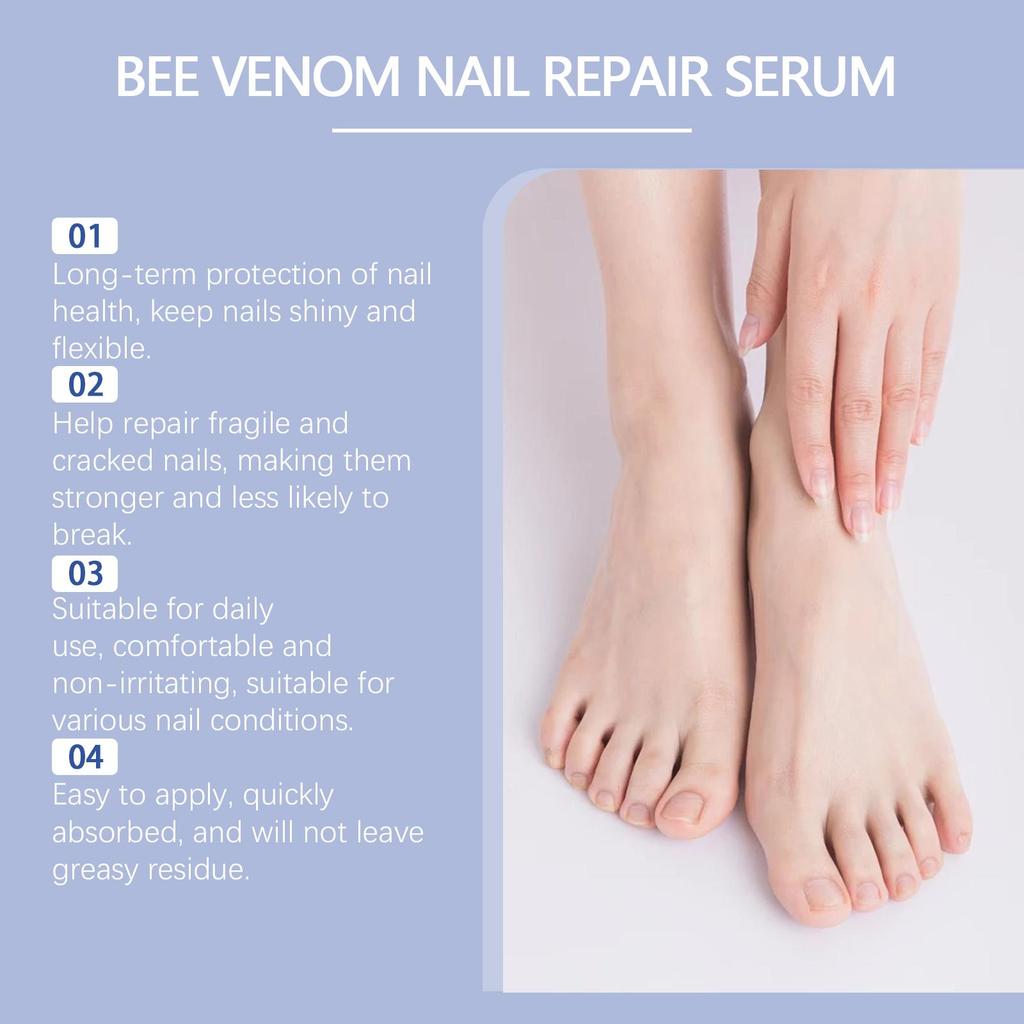 Nail Fungus Treatment Serum Spray Repair Dryness Cracking Infection Fungal Nail Remove Inflammation Swelling Foot Care Products