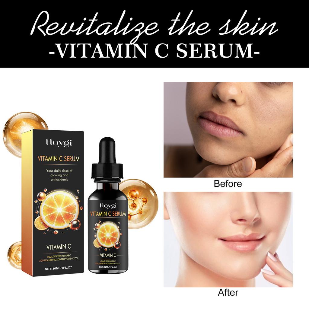 Hoygi Vitamin C Serum For Deep Hydration Brightening And Firming Skin Care 30ml