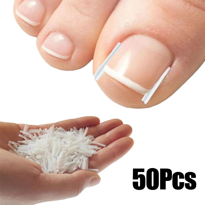 Ingrown Toenail Correction Tool Elastic Patch Nail Filling Pad Toe Straightening Clip Brace Ingrown Nails Pedicure Treatment