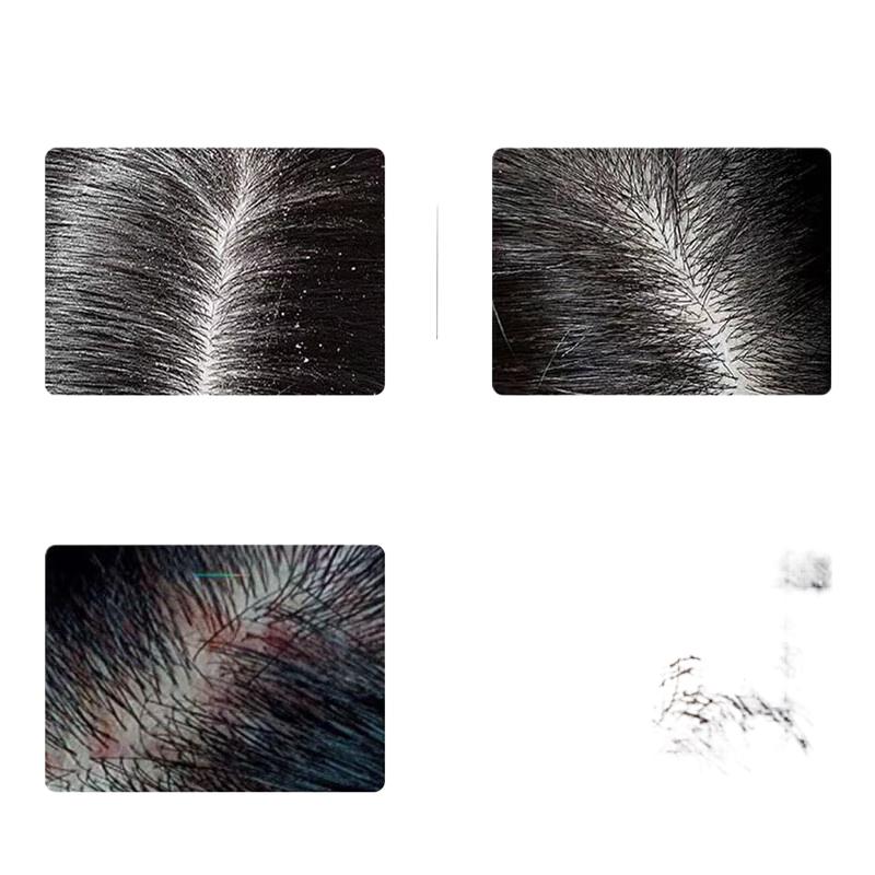 

Spes Bisabolol Peptide Anti-Dandruff Shampoo & Conditioner Set