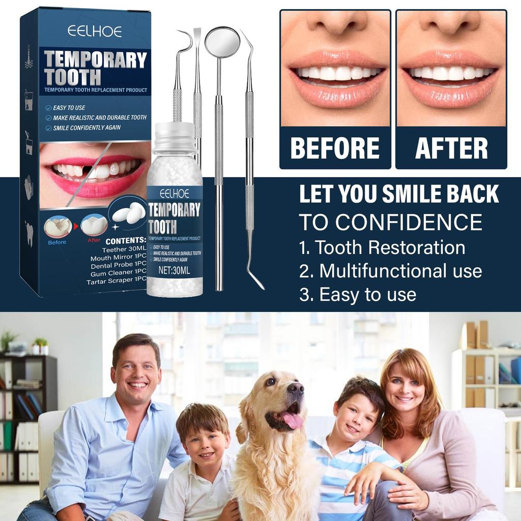 30ml Teeth Repair Kit Temporary Solid Tooth Hole Repair Materials Practical Unisex Adults with 4 Dental Tools Tooth Beauty Tool