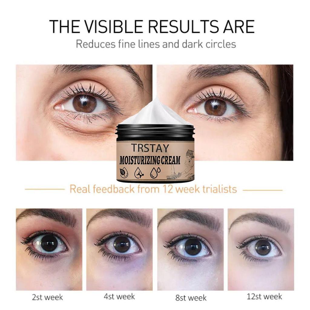 Eye Cream That Reduces Pigmentation and Brightens the Skin, Is Gentle and Non-irritating, Leaving the Skin Soft and Delicate