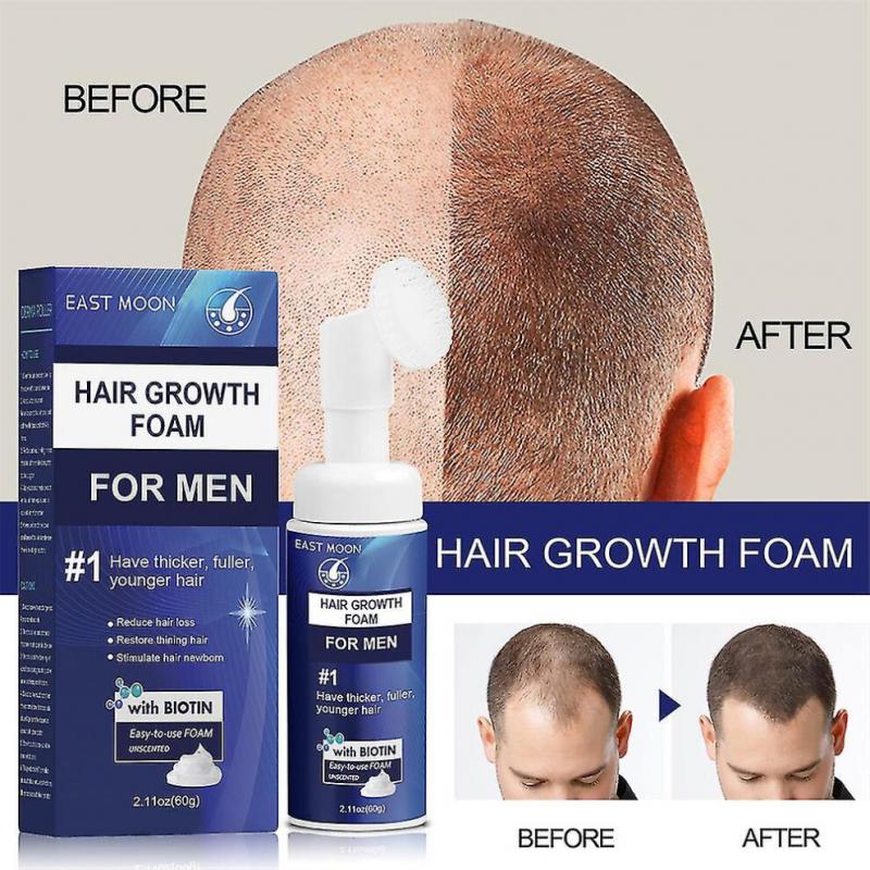 3pcs Regaine For Men Hair Loss Regrowth Scalp Foam - Extra Strength-yvan