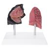 Anatomical Smoker Lung And Healthy Lung Demonstration Tool PVC Clinical Teaching Aid For Classroom Use