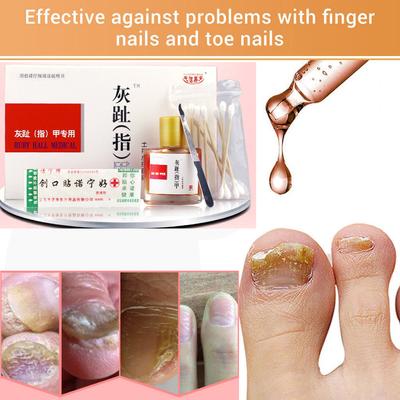Nagelwerkzeuge Nagelwerkzeuge Modische Nagelreparatur-Essenz Befeuchten Kunstpflege Pflege für trockene, rissige Nagelhaut Nagelpflege Nagelwerkzeuge