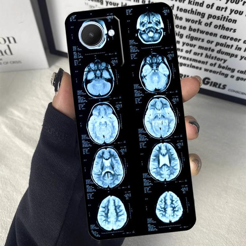 

Радиологический Скелет Человеческих Органов Для Realme C63 C71 C55 C67 C51 C75 C61 C65 C53 10 11 12 13 14 15 Pro Plus GT6 GT7 Pro Чехол Realme C31