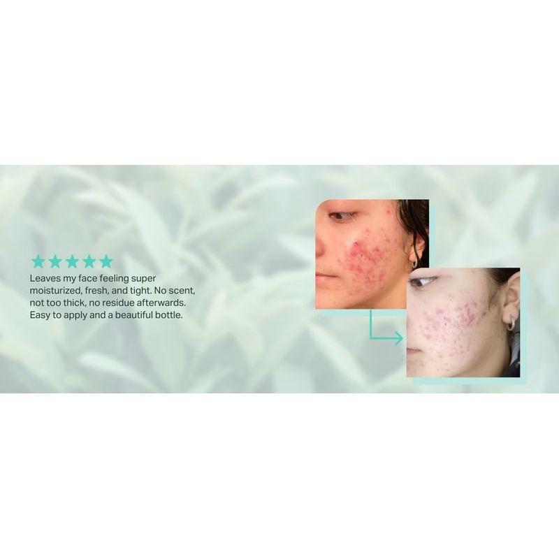 BRING GREEN - Zink Teca Unreinheiten Serum