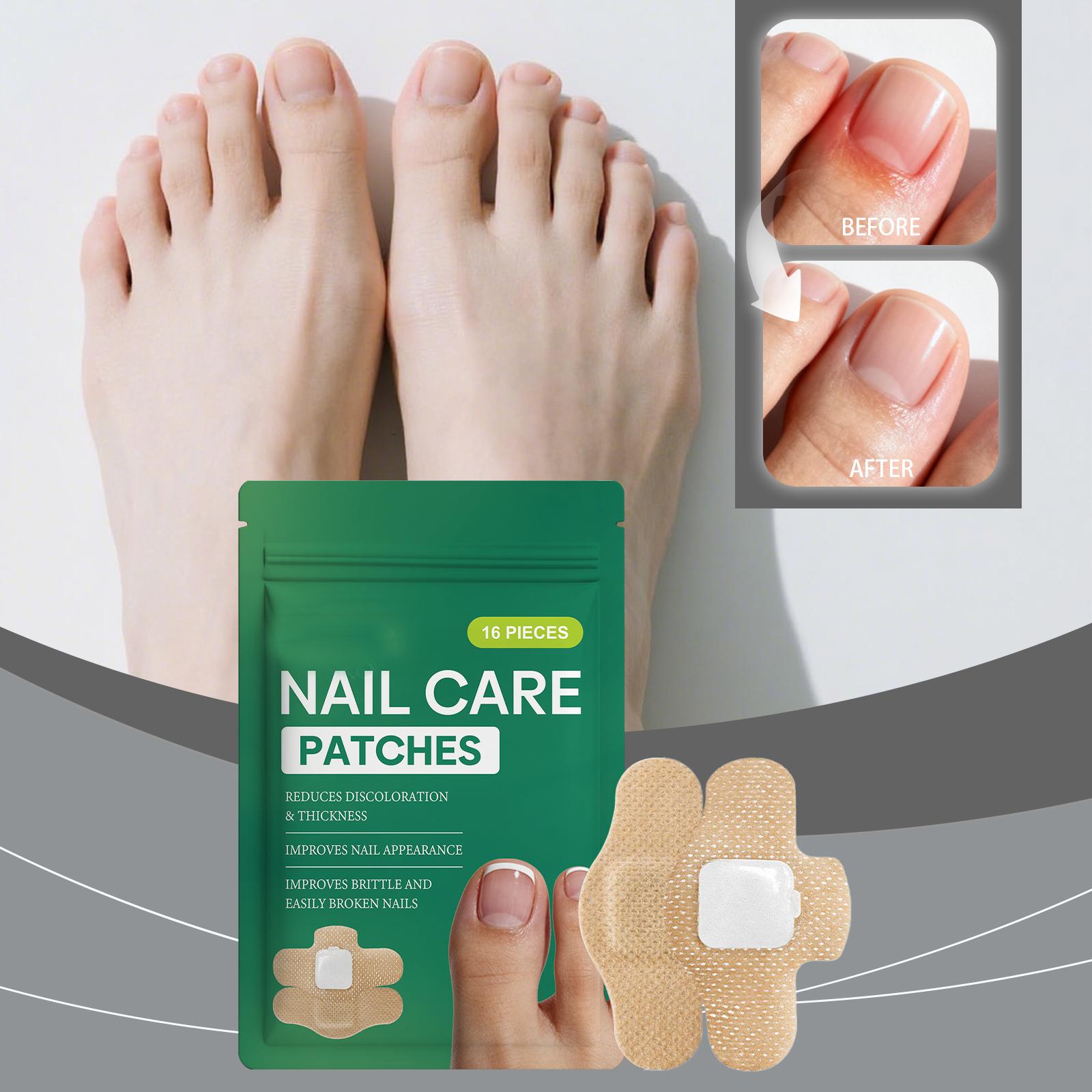 

Nail Care Patches 16 Pieces for Nail Discoloration and Thickness Reduction Improves Nail Appearance and Supports Brittle Nail Repair one size белый
