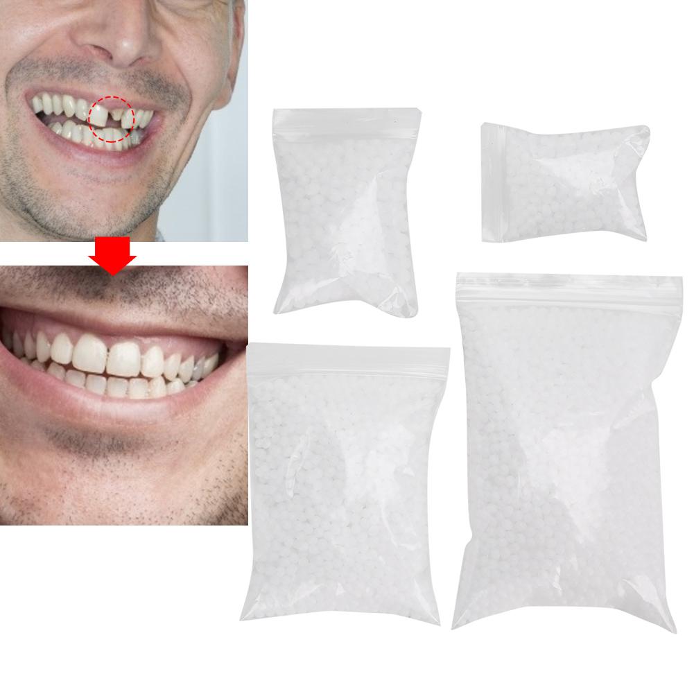 Broken Teeth Repair Temporary Tooth Repair Beads for Missing Broken Teeth Dental Tooth Filling Material 3