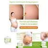 Ouhoe Skin Smoothing Cream Moisturizing Formula For Scar Reduction And Stretch Marks