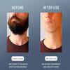 Classic 6-layer Manual Razor Set, 1 Handle With 12/18 RefillsStainless Steel Manual Shave Razors For Daily Face Care