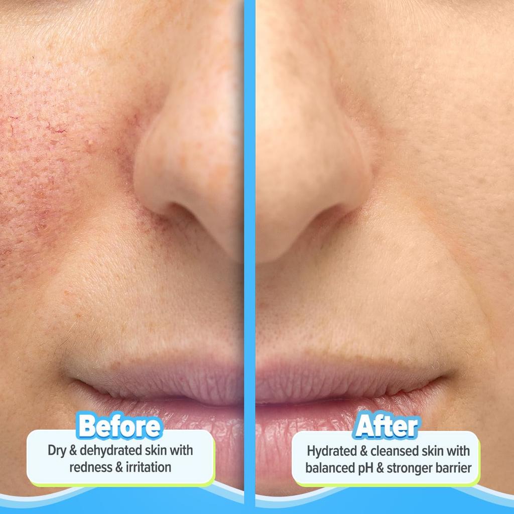 Aqualogica 5 Barrier+Repair Gentle Face Cleanser With Avocado & Ceramides 100 ml For Dry To Sensitive Skin