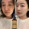 Face Whitening Cream Dark Skin Spots Scars Snow White Oil Day Night Face Cream Skin Whitening Korean Skin Care Products