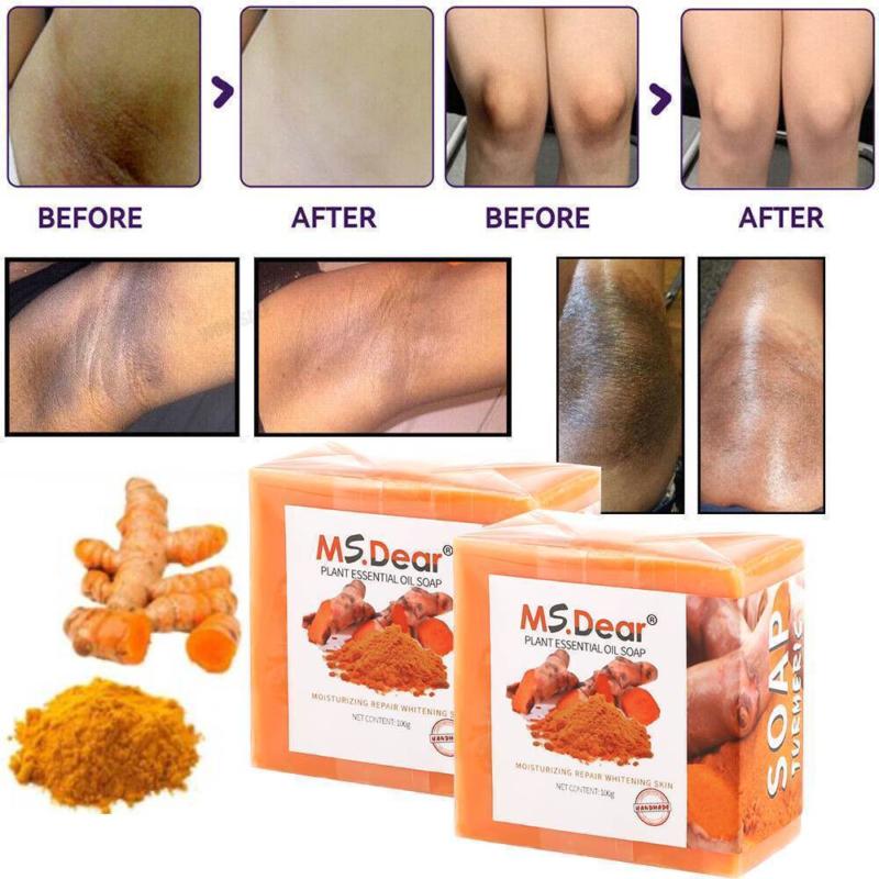 2× Turmeric Soap Skin Whitening Dark Spots Lightening Acne Brightening Turmeric