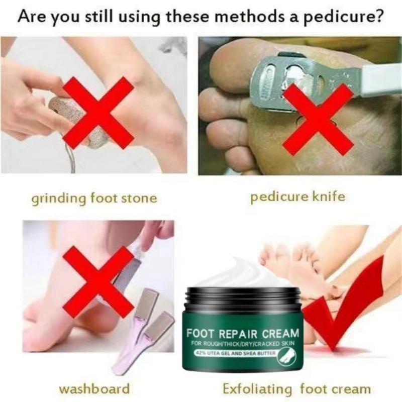 Effective Odor Treatment Nourishing Anti Cracking Cream Skin Care Products Dead Skin Remover Chapped Repair Cream